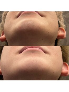 フェリーバ 浦和店(FELIVA)/Before&After