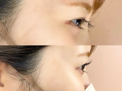 ベリーアイズ 町田店(Berry Eyes)の写真