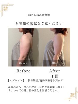 ウィズリリナ 新横浜(with Lilina.)/デスクワークによる巻き肩猫背に