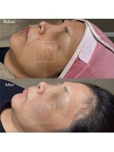 韓美(KANBI)/韓国肌管理Before After