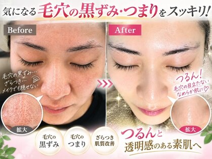 イアリイの写真