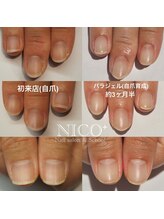 ニコプラス(NICO+)/パラジェルクリア補強