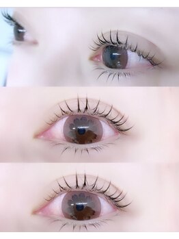 ビラ ベルダ(Bira Beldad)/まぶたリフトUP