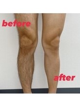 メンズ シンバ(SIMBA)/☆ ビフォーアフター ☆