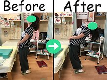 杉本接骨鍼灸院/左側のお尻から脚にかけての激痛