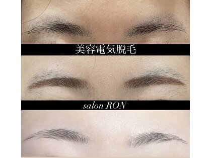 ロン(RON)の写真