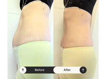 ゆう/みんな薄くなっていく