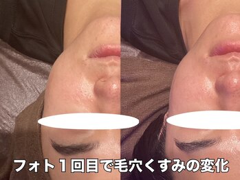 リエル(RIEL)/【フォト】