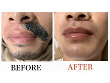 メンズブリリアンス/感動の仕上がり！ヒゲワックス