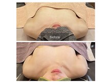 ベンザイ 梅田店(BENZAI)/左右差、バスト崩れ、疲れ、癒し