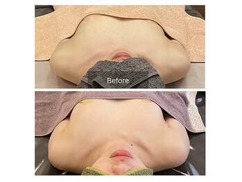 ベンザイ 梅田店(BENZAI)/左右差、バスト崩れ、疲れ、癒し