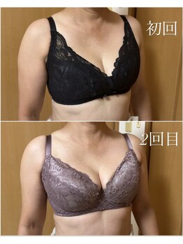 エース(A)/CカップからＦカップへ