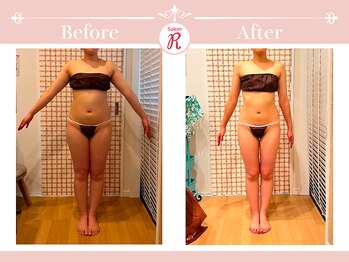 サロン アール(Salon R)/痩身施術×食事・インナーケア