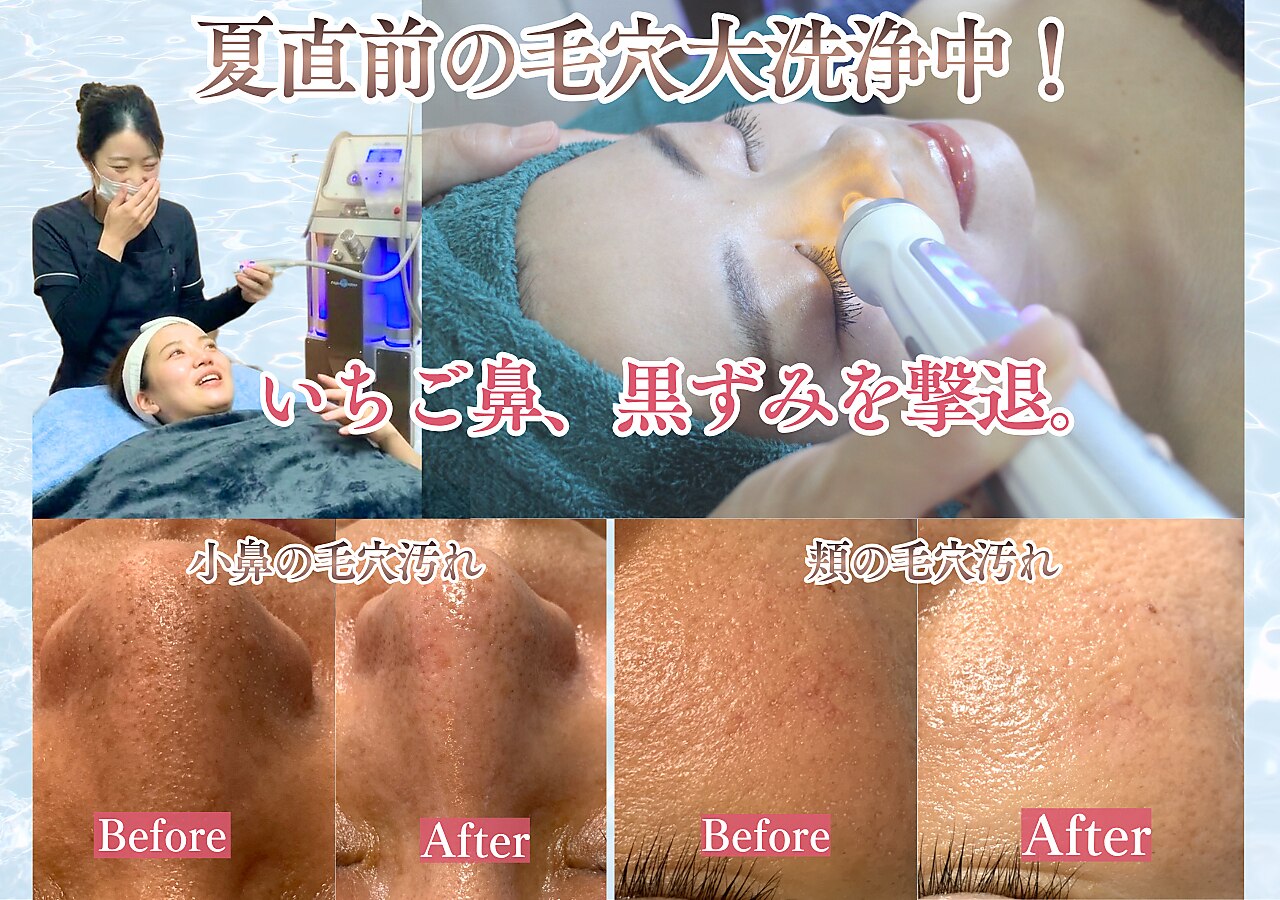 本町駅で毛穴ケアが人気のエステサロン｜ホットペッパービューティー