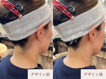 クラームビューティー(Clerm beauty)/美容師によるうなじデザイン脱毛