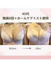 ミミバスト(mimibust)/バストアップBeforeAfter