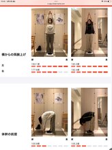 ピエール ナリタイラボ(Piel NARITAI LABO)/骨盤＆猫背施術