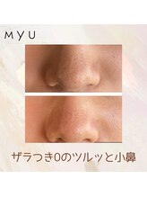 ミュー(professional beauty salon MYU)/【毛穴ケア】ハイドロ毛穴洗浄