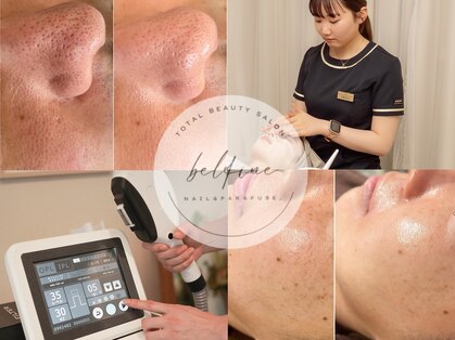 ベルフィーヌ(belfine)の写真