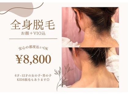 ミアンカ(mianca)の写真