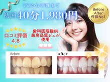 ホワイトニングショップ 福岡春日店