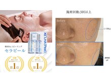 ユウドット(yuu.)の雰囲気（韓国発！次世代ピーリング艶、透明感あるお肌に！）