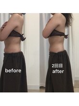 ジョワイユ(Joyeux)/腸の位置でお腹は変わる