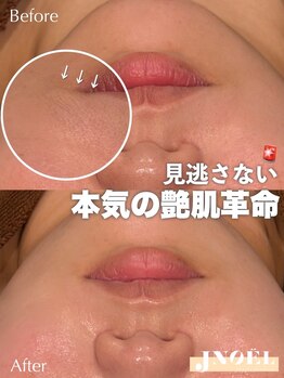 ジェノール 2nd beauty studio 姫路駅前店(JNOEL)/本気の艶肌革命フェイシャルWax
