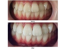 コアルナ センター北店(Coalna)/歯科提携・セルフホワイトニング