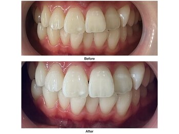 コアルナ センター北店(Coalna)/歯科提携・セルフホワイトニング
