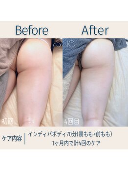 スー(Sue)/上向きヒップはインディバで作る