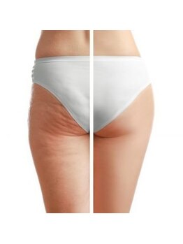 パリス デ スキン 岐阜マーサニジュウイチ店(Paris de skin)/スリムムーヴ痩身