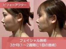 ボディアーキ 松山店(BODY ARCHI)の雰囲気（ボディもフェイシャルも月額制で追加料金なくマシン使い放題！）