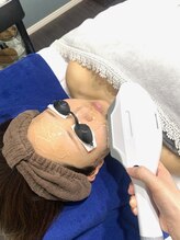 ハーニーズ(HARNEYS)/【美肌顔脱毛】照射