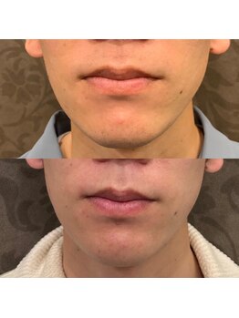 フェリーバ 浦和店(FELIVA)/Before&After