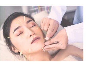 プラチナサロン 六本木の写真/鍼灸＆整体でお顔だけでなく首肩コリや頭痛の改善を◎内臓の働きを整えて根本改善♪肌悩みにアプローチ☆