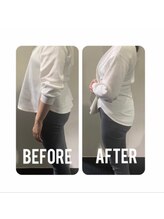 レア(Lea)/施術回数1ヶ月/反り腰