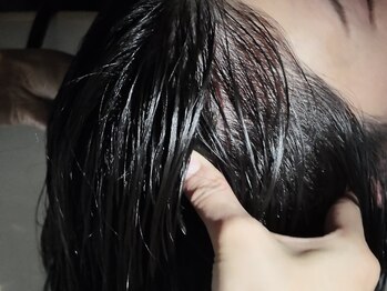 メルヴィー 六本松(MELVIE)/SCALP MASSAGE 