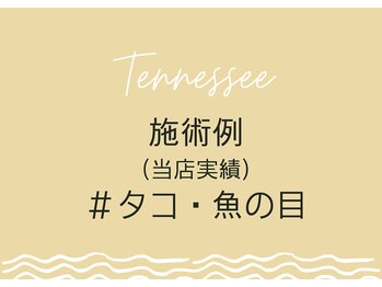 テネシー/