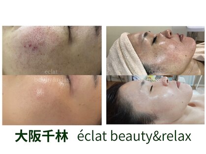 エクラ(eclat)の写真