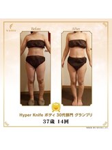 リンカ(Rinka.)/☆帯広初!!ハイパーナイフ導入☆