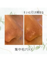 ミュー(professional beauty salon MYU)/【毛穴ケア】ハイドロ毛穴洗浄