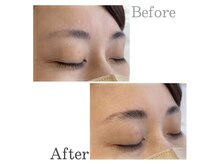 グランミューズ(Gran Muse)/ハリウッドブロウリフト