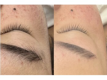 ラニ(Lani)/女性も男性も♪フェイシャルWAX