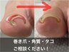 60分【初来店の方】【フットケア】トラブルネイル・巻き爪ケア 足親指1本