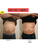 ウル バイ ラシック(Ulu by Lasic)/【脂肪分解】上半身ダイエット◎