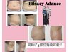 【OPEN記念】大特価！話題の脂肪冷却4部位+深部リンパマッサージ90min