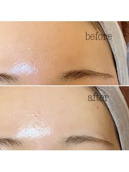 アイラッシュTokyo銀座サンクチュアリ/LED/眉毛/パリジェンヌ/バインド