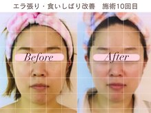 小顔コルギアンドフェイシャルサロン ジュエル(JEWEL)の雰囲気（エラ張り、顔幅を解消！どんな角度も自信が持てる小顔美人に♪）