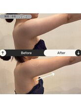 ラヴニール(L'avenir)/二の腕もすっきり♪